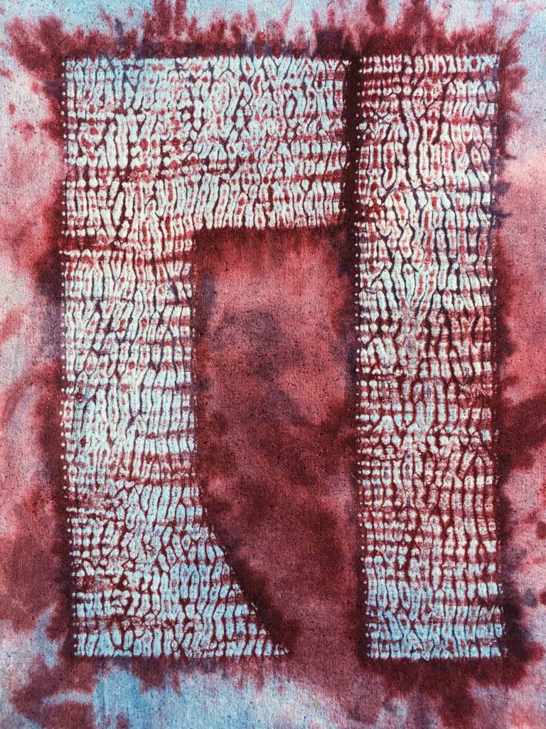 Stitches Removed